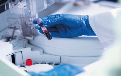 Citometría de Flujo